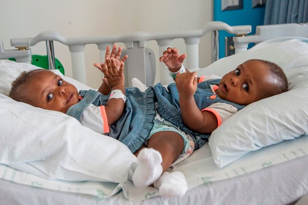 In this Sept. 6, 2016 photo provided by the Le Bonheur Children’s Hospital, conjoined twins from Nigeria, Miracle and Testimony Ayeni, sit at Le Bonheur Children's Hospital before being separated in Memphis, Tenn. The girls were conjoined at the lower half of the body and separated following about an 18-hour procedure. (Lisa W. Buser/Le Bonheur Children’s Hospital via AP)