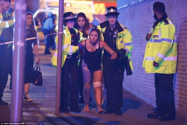 Manchester Arena blast: one of the injured persons at the Arena