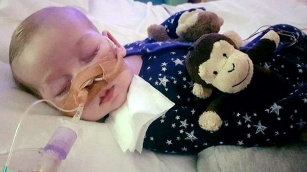 Charlie has a rare genetic condition and would not live to see his first birthday, his father said