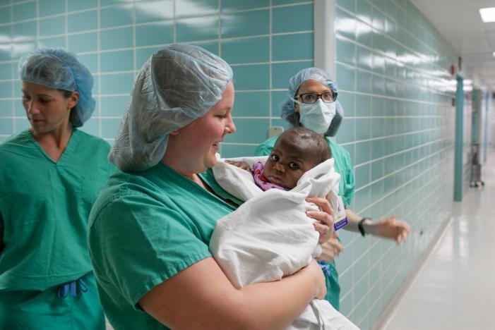 Girl born with four legs is separated from parasitic twin