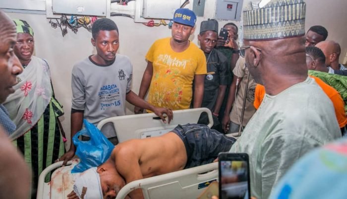 Another APC member was attacked in the head by PDP thugs