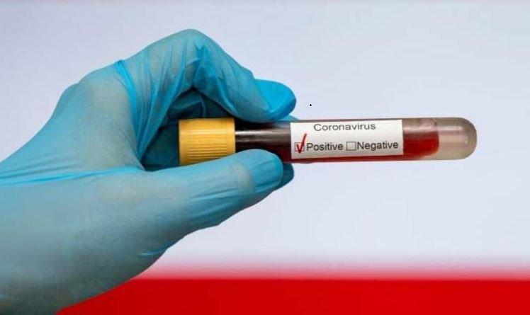 ‘Man charged for disclosing patient’s Covid-19 status’ The Zimbabwean civil servant is now out on bail, according to a state-owned newspaper