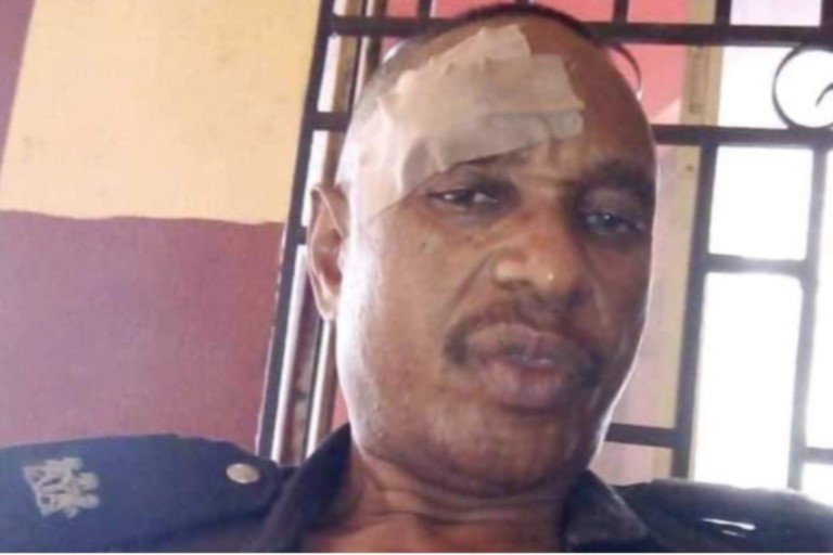 SP Alimeke Ignatius, DPO of Obantoko Division was injured by the students in Ogun state
