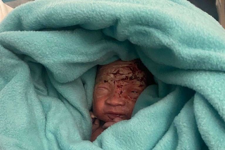 Both the mother and baby are said to be doing well