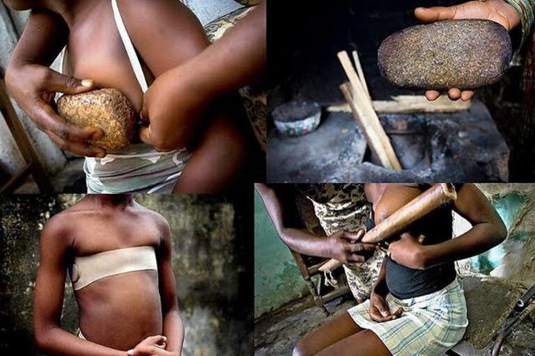 Age-long tradition breast ironing could lead to cancer in the affected girls