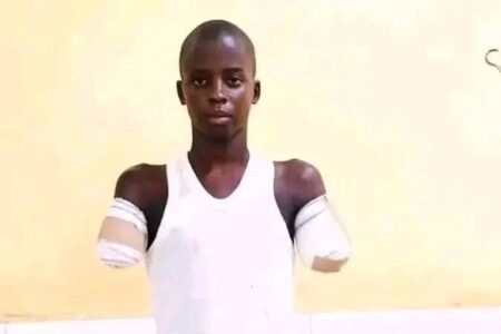 Gombe NBA condemns 12-year-old’s amputation over phone theft