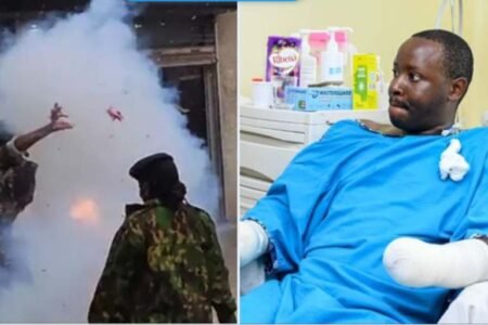 Policeman loses both arms attempting to throw teargas at protesters