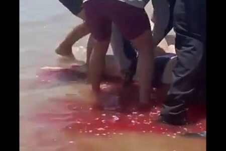 Woman bitten by shark while swimming