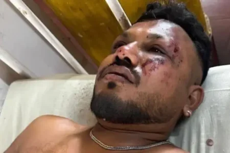 Vishwash Kumar Ramesh, the British passenger that survived the Air India plane crash