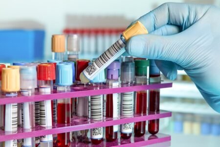 Scientists develop blood test that detects over 50 types of cancer Scientists develop blood test that detects over 50 types of cancer