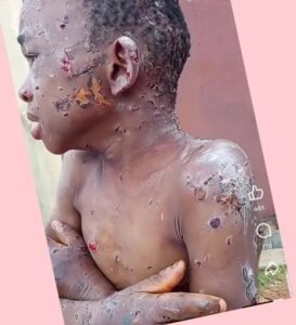 Anambra vows justice for assaulted 10-year-old boy Anambra vows justice for assaulted 10-year-old boy