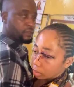 Gwamnishu confirms husband's arrest over assault of 18-year-old wife