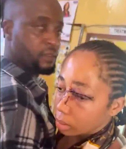 Gwamnishu confirms husband’s arrest over assault of 18-year-old wife Gwamnishu confirms husband's arrest over assault of 18-year-old wife