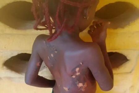 Police arrest Anambra mother for burning daughter with hot knife